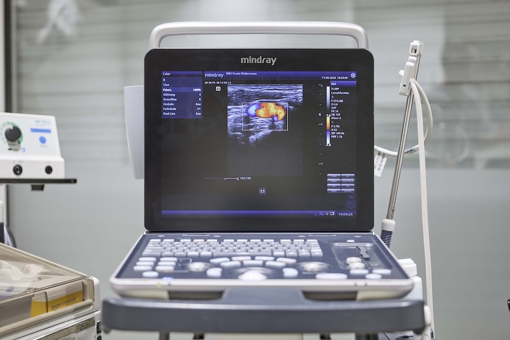 Gerät der Sonographie für Untersuchung in der HNO-Praxis